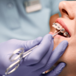 Nie tylko estetyka: jak ortodoncja koryguje wady zgryzu?